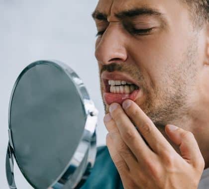 Man looking in a handheld mirror, portraying white spots on gums and the need for a periodontist